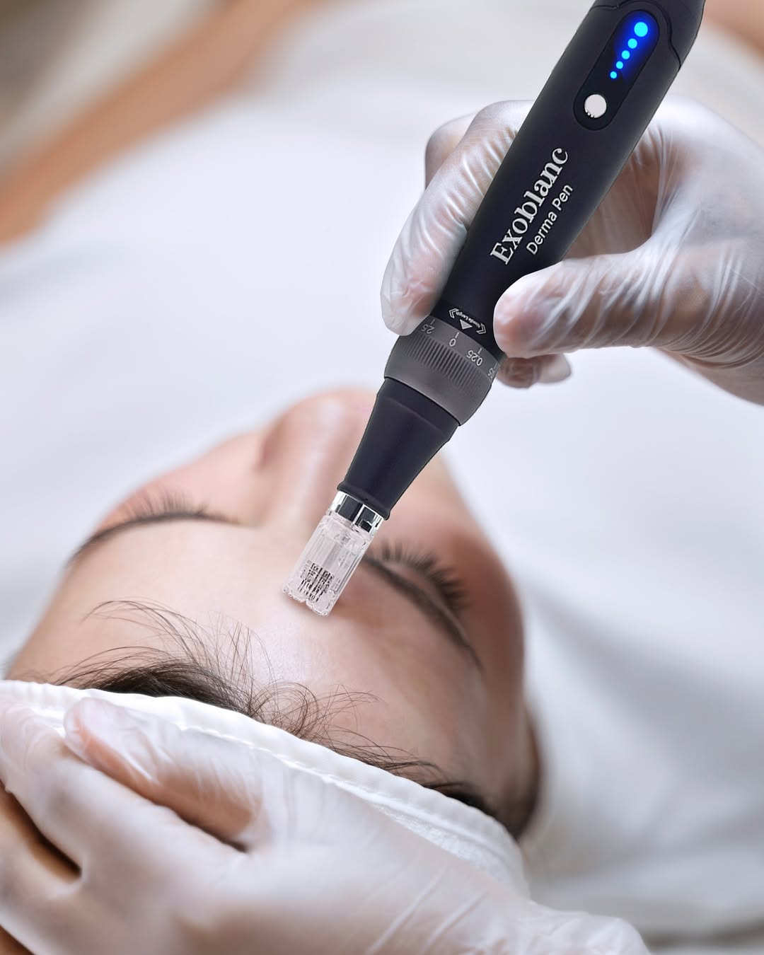 ExoBlanc Derma Pen