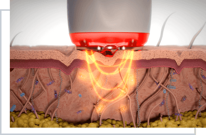 Apollo Duet | Multifunctional RF Skin Therapy System