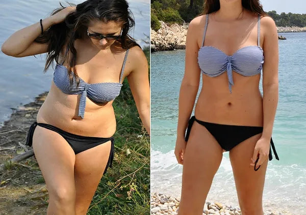 Gemstone Body Sculpting Laser | Non-Invasive 532nm Green Laser