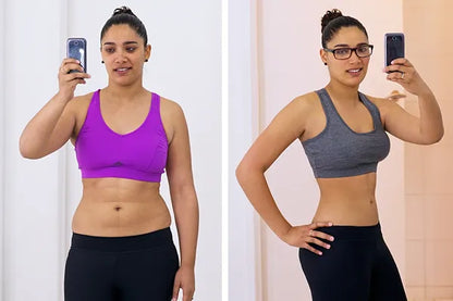 Gemstone Body Sculpting Laser | Non-Invasive 532nm Green Laser